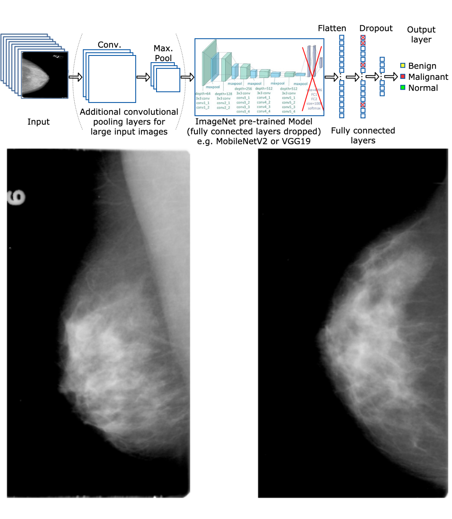 Image of a mammography